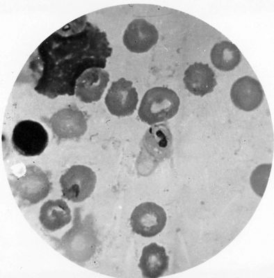 Trypanosoma gambiense - forma a Leishmania in fase ameboide e con nucleo e blefaroblasto in divisione semplice