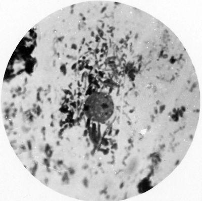 Trypanosoma gambiense - forma a Leishmania in divisione binaria: i blefaroblasti si sono già separati