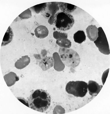 Trypanosoma gambiense - forme a Leishmania in divisione multipla