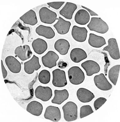 Trypanosoma gambiense - forme postleishmaniche