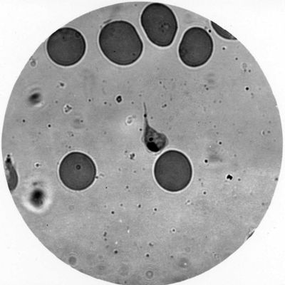 Trypanosoma gambiense - forma a girino con blefaroblasto anteriore (notare le successive emigrazioni del blefarobalsto, che da anteriore diviene posteriore)