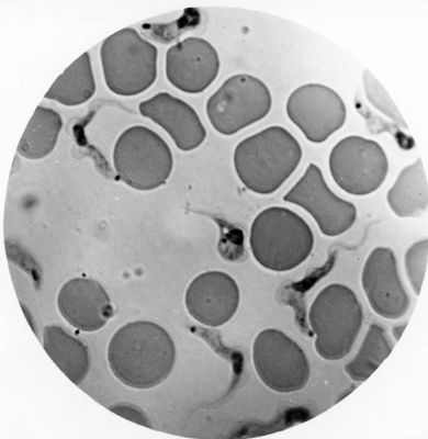 Trypanosoma gambiense - forma a girino con blefaroblasto alla stessa altezza del nucleo
