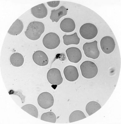 Trypanosoma gambiense - forma a girino con blefaroblasto posteriore