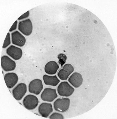 Trypanosoma gambiense - forma pretripanosomica