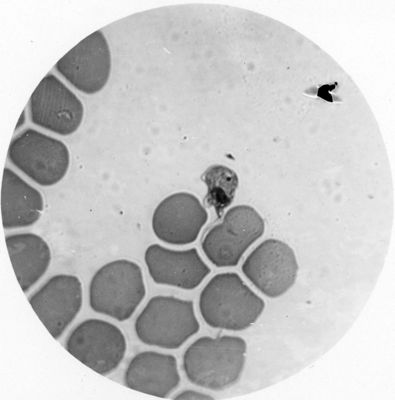 Trypanosoma gambiense - forma pretripanosomica