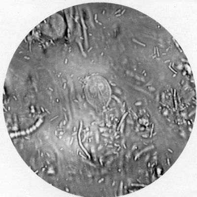 Forma vegetativa di Giardia intestinale (a fresco)