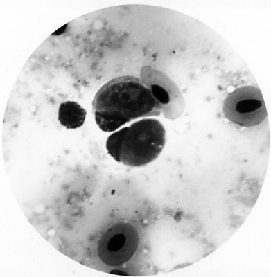 Due Leucocytozoon probabili gameti maschili (a destra) e femminili (a sinistra)