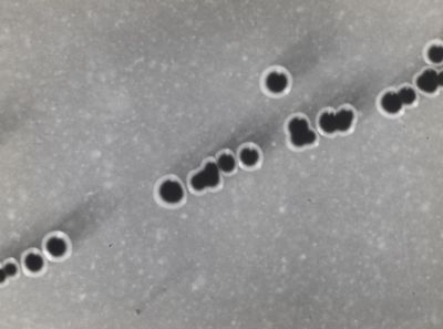 Fotografie di Corynebacterium diphtheriae