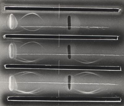 Fotografia di Immunoelettroforesi di microbatteri