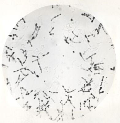 Microfotografie di Corynebacterium diphteriae