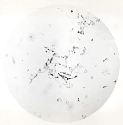 Fotografie di Corynebacterium diphteriae