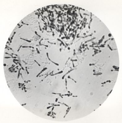 Fotografia di Corynebacterium diphteriae