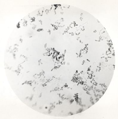 Fotografia di Corynebacterium diphteriae