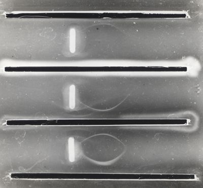 Immunoelettroforesi di micobatteri