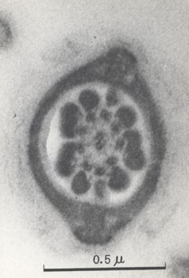 La spermatogenesi studiata al Microscopio elettronico