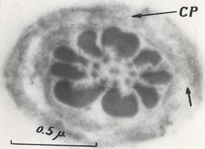 La spermatogenesi studiata al Microscopio elettronico