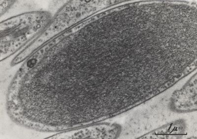 La spermatogenesi studiata al Microscopio elettronico