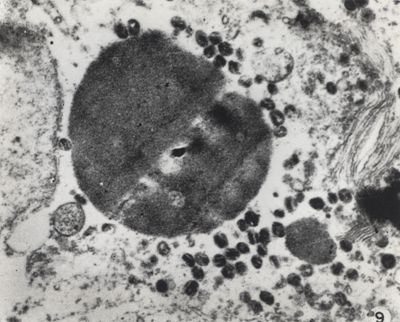 Virus dell'ectromelia