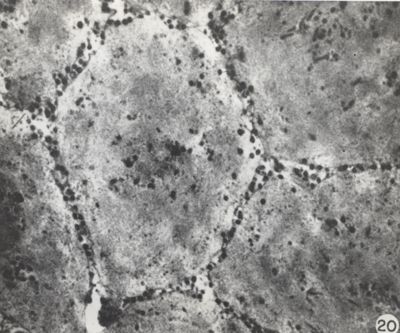 Cellule Corneali circondate da virus del vaiolo extracellulare