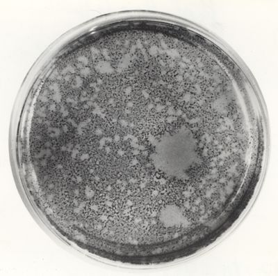 Placche da virus in piastra di Petri