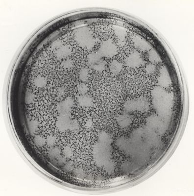 Placche da virus in piastra di Petri