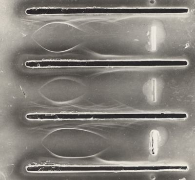 Immunoelettroforesi di tubercolare