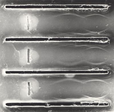 Immunoelettroforesi di tubercolare