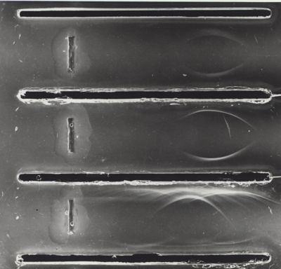 Immunoelettroforesi di tubercolare