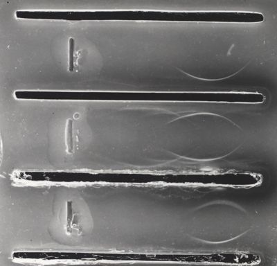 Immune elettroforesi di tubercolare