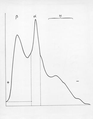 Diagramma riguardante l'elettroforesi su carta di proteine muscolari