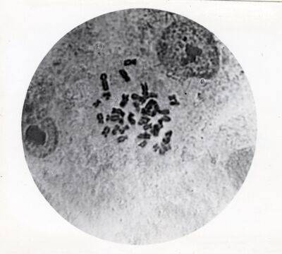 Cromosomi di cellule in coltura