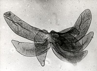 Foto del filamento respiratorio pupale di dittero Simulide di Simulium sp. (probabilmente sottogenere Nevermannia, specie equinum)