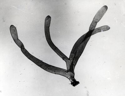 Foto del filamento respiratorio pupale di dittero Simulide di Simulium sp. (probabilmente  sottogenere Obuchovia, specie auricoma)