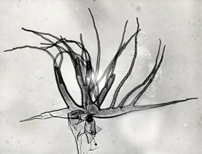 Foto del filamento respiratorio pupale di dittero Simulide di Prosimulium sp. (probabilmente  sottogenere Urosimulium, specie aculeatum)