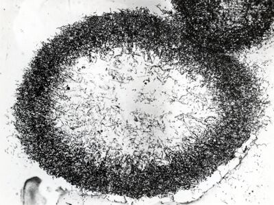 Forme di Penicilium Chrysogenum in coltura sommersa