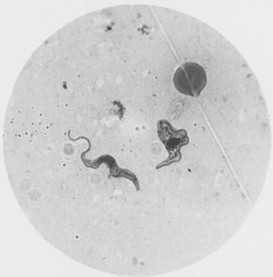 Trypanosoma gambiense - ?