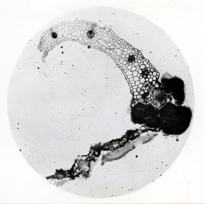 Sezioni di segala infettata da Claviceps