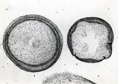 Sezioni istologiche di colonne di Aspergillus Flavus