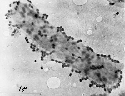 Batteriofagi visti al microscopio elettronico