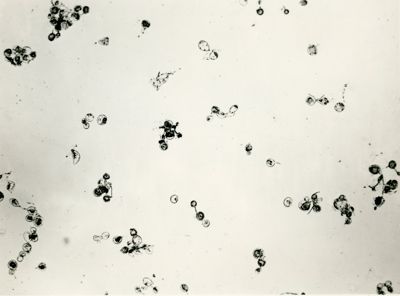 Forme di clamidosporiche di Penicillium in Agar