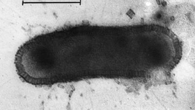 Batteriofago visto al microscopio elettronico