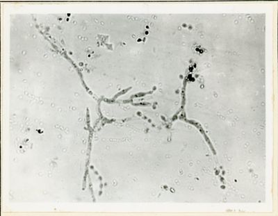 Nuclei di Penicillium Chrysogenum in Cultura Sommersa