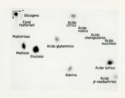 Metabolismo intermedio dei carboidrati