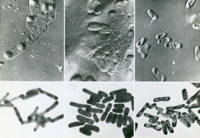 Escherichia coli, ceppo K 12 da Kellenberger