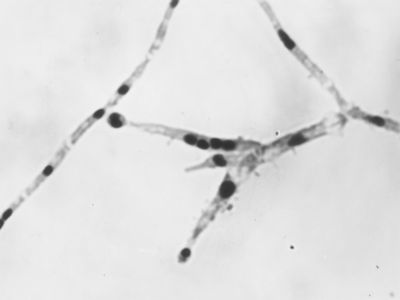 Nuclei di Penicillium Chrysogenum in cultura sommersa