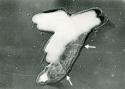 Mycobacterium tuberculosis