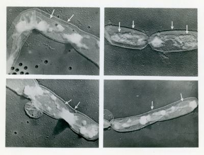 Bacillus anthracis, ceppo Zolla