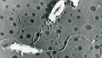 Cellule di Vibrio metschnikovii da Van Iterson