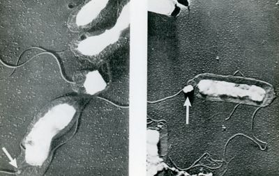 Clostridium botulinum