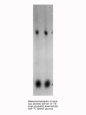 Metabolismo del glucosio nel cervello di ratto